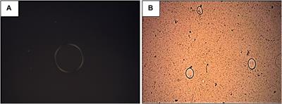 Incorporation of Nonyl 3,4-Dihydroxybenzoate Into Nanostructured Lipid Systems: Effective Alternative for Maintaining Anti-Dermatophytic and Antibiofilm Activities and Reducing Toxicity at High Concentrations